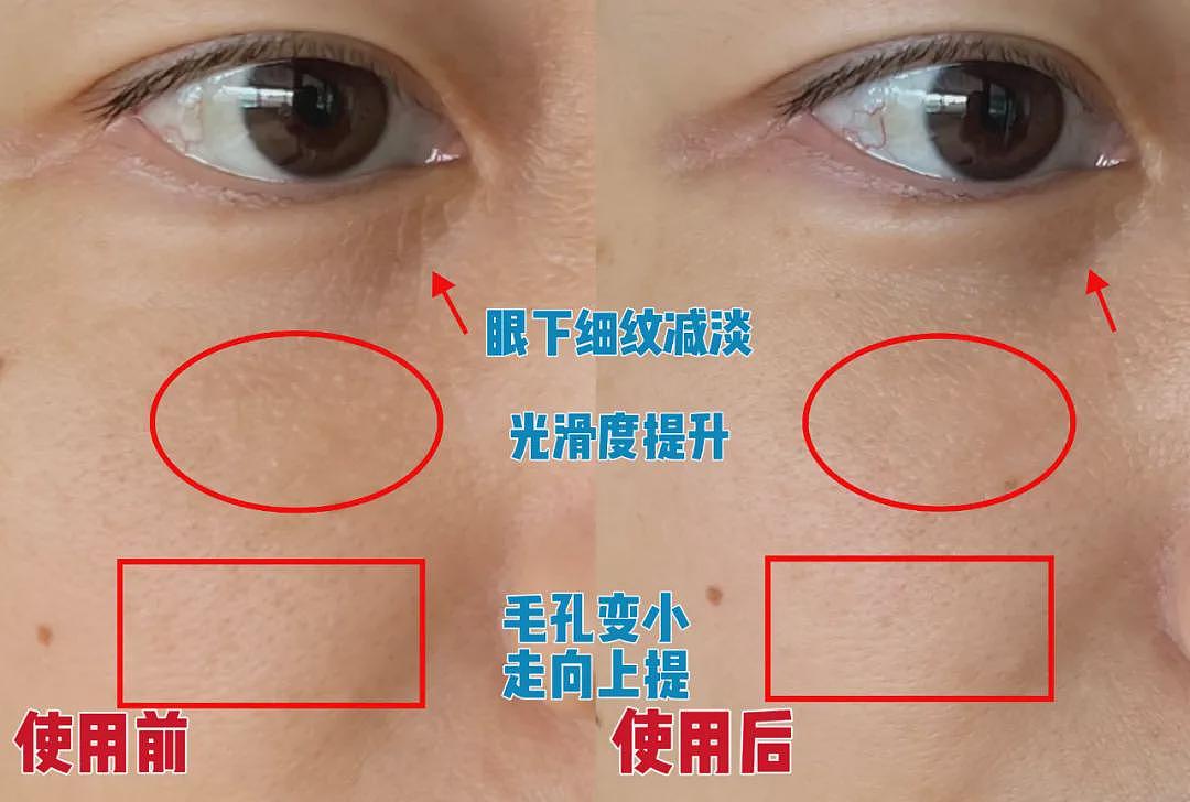 几大【祛皱利器】对比分析：选对了，让你事半功倍！（组图） - 7