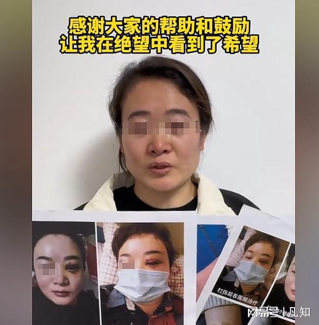 郑州女子曝知名企业家常年家暴：被迫喝尿、发生关系，四个月流产两次（组图） - 22