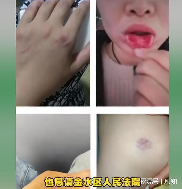 郑州女子曝知名企业家常年家暴：被迫喝尿、发生关系，四个月流产两次（组图） - 9