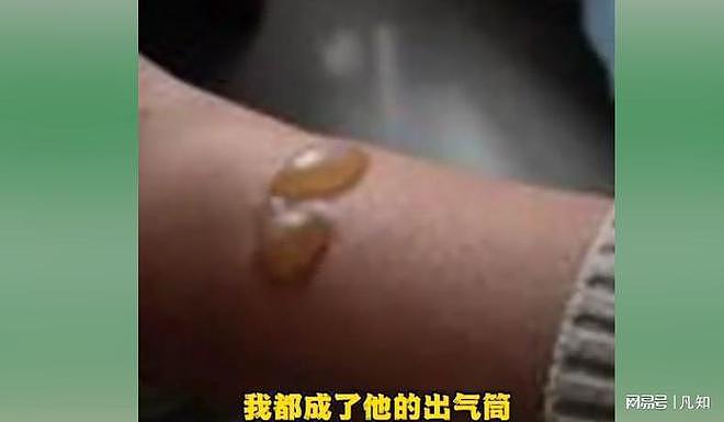 郑州女子曝知名企业家常年家暴：被迫喝尿、发生关系，四个月流产两次（组图） - 10