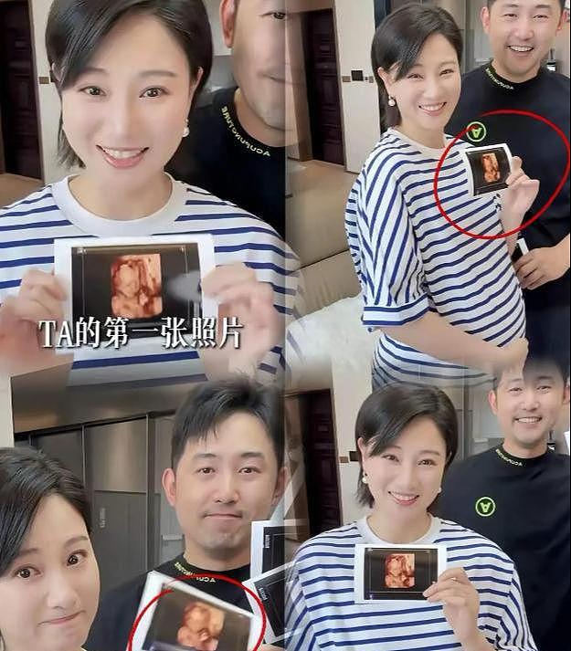 40岁演员侯梦莎官宣怀孕！晒孕肚照激动落泪，结婚四年备孕艰辛（组图） - 3