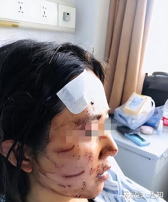 郑州女子曝知名企业家常年家暴：被迫喝尿、发生关系，四个月流产两次（组图） - 7