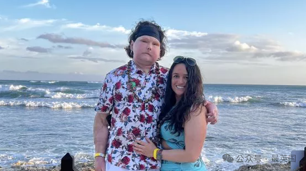 帅哥彻底毁容，脸被烧没了，你还会爱吗？全球首例“换脸换手”男子迎娶真爱，网友炸锅（组图） - 18