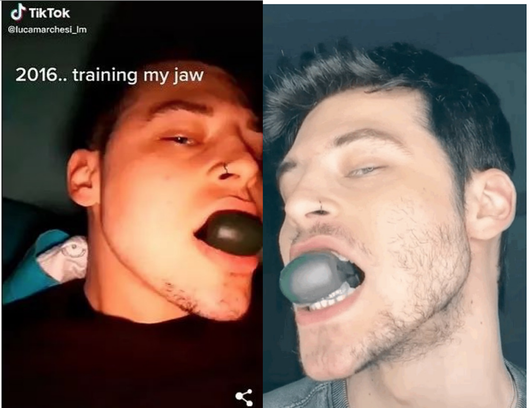 小哥挑战只练一侧肌肉，左边壮汉右边细狗！竟是因为“不想太受欢迎”…（组图） - 5