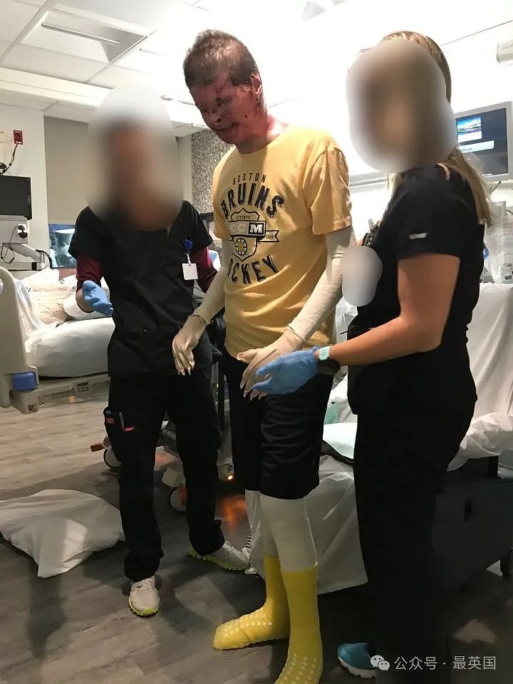 帅哥彻底毁容，脸被烧没了，你还会爱吗？全球首例“换脸换手”男子迎娶真爱，网友炸锅（组图） - 9
