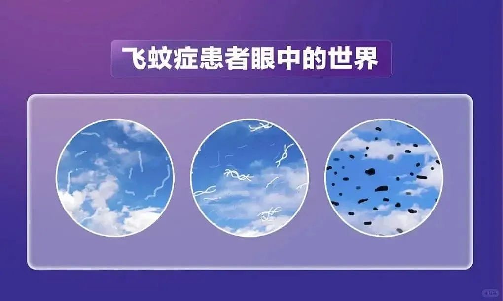 当代人，正在被这种“绝症”折磨......（组图） - 2