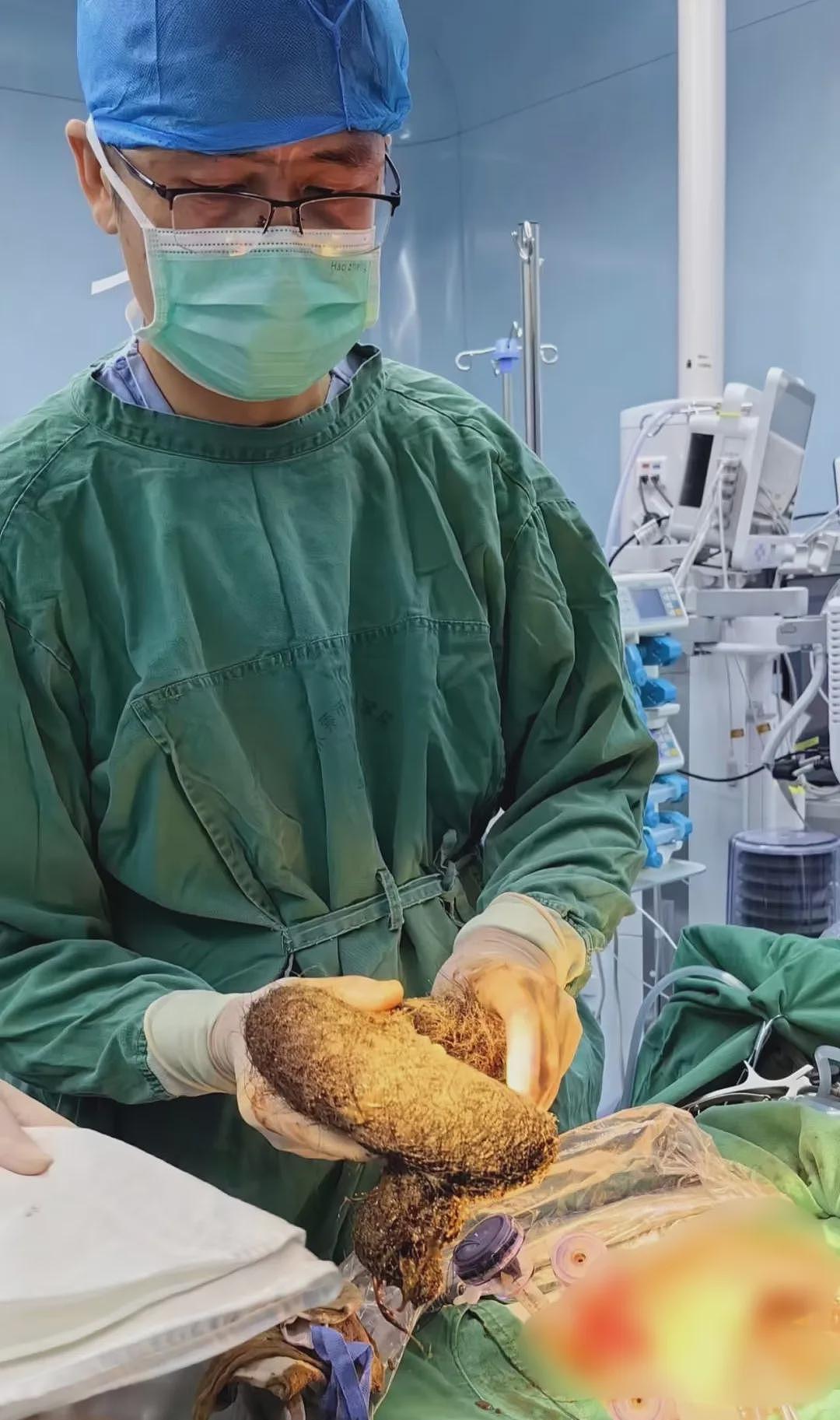 上海一医院接诊!10岁女孩体内这一幕惊呆,有人因羞耻感延误就医,必须重视(组图) - 4