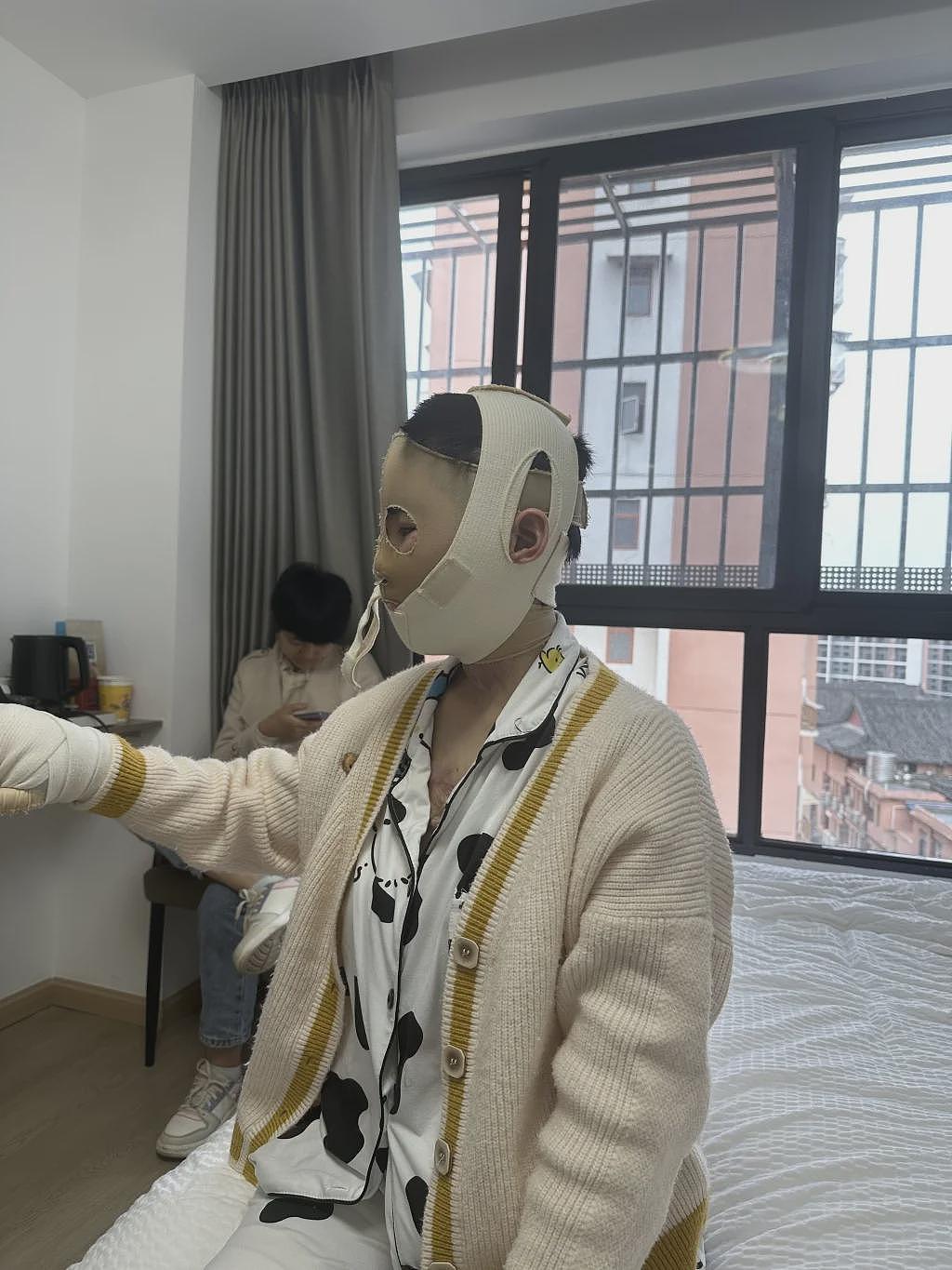 被前男友泼汽油致残后，一个女孩经历的双重灼烧（组图） - 2