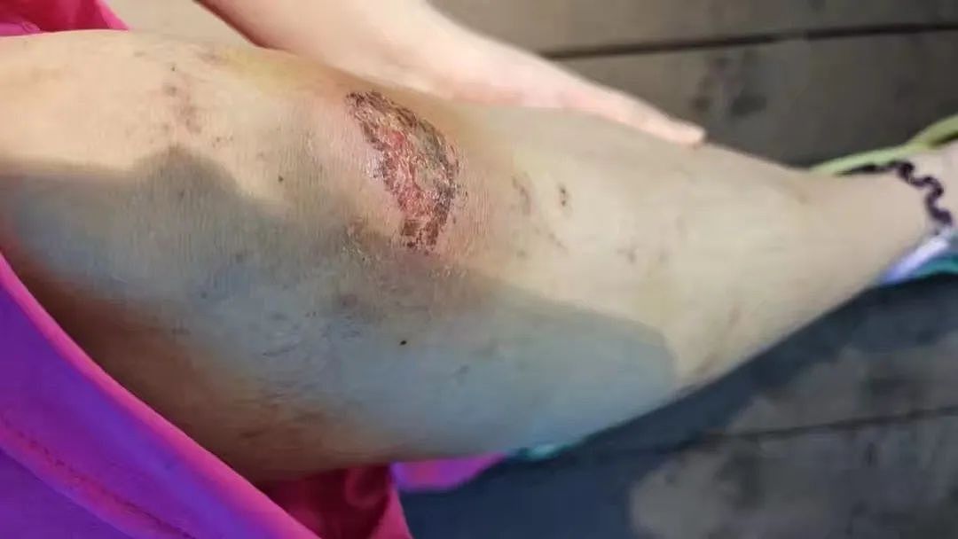 “美人鱼”女孩溺水进了ICU,危险的青春饭(组图) - 10