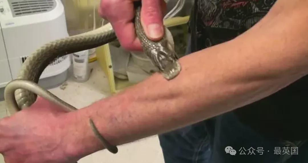 疯狂实验！科学家自愿让毒蛇咬200次，还给自己注射700多剂毒液，血液竟能救命（组图） - 8