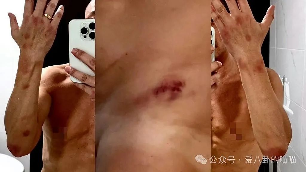 《风云》“秦霜”扮演者惨遭男友人迷奸,网友却看笑话:自己作的(组图) - 11
