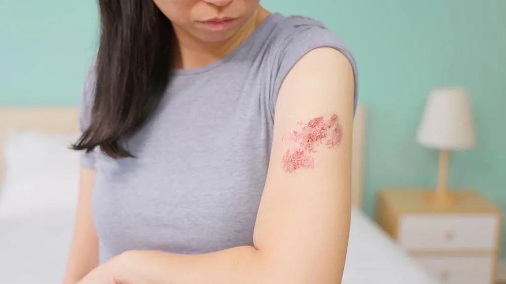 在减肥的澳洲人注意了:小心染上这个剧痛的病!(组图) - 2