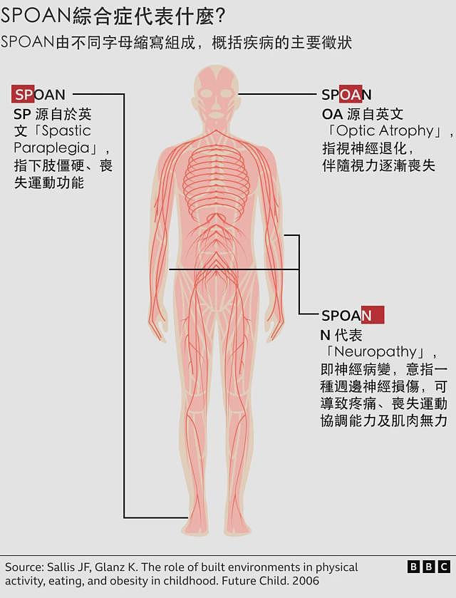 巴西偏远小镇罕见病症的断症之路——“几乎人人都是亲戚”（组图） - 3