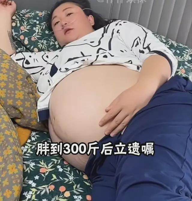 “女吃播三巨头”现状：脸像骷髅、摘除味觉神经，有人已立好遗嘱（组图） - 17