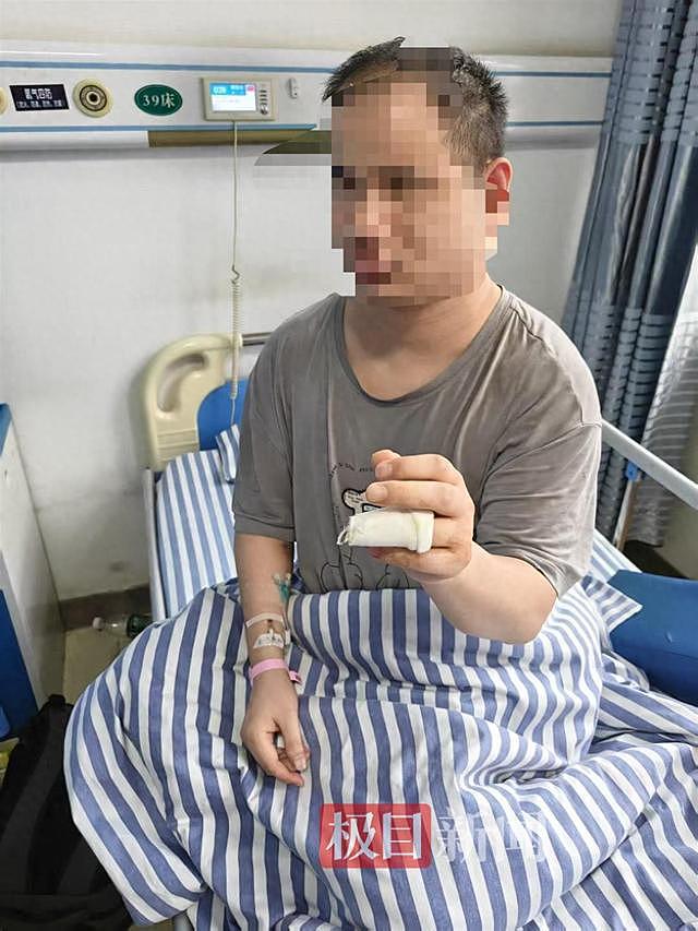 盲人体验小米汽车导致手指骨折，小米表示已走保险（组图） - 1