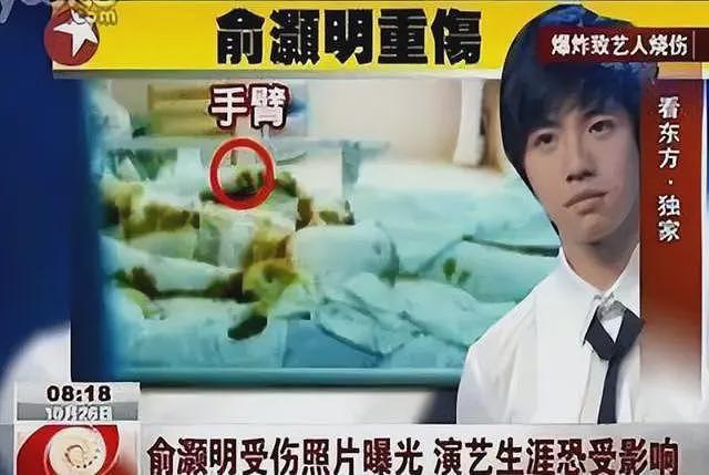 俞灏明：23岁毁容被女友抛弃，如今靠3克拉钻戒拿下胡歌前女友（组图） - 32