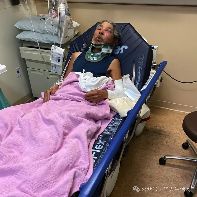 讽刺!71岁教授讲了一辈子“种族歧视”,却被暴力撞伤怒骂:滚回你的国家(组图) - 4