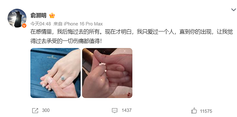 热搜第一!俞灏明、王晓晨官宣结婚,男方15年前曾在拍戏时遇火灾容貌受损(组图) - 2