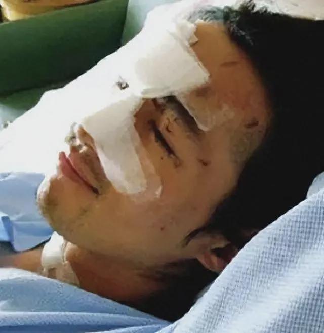 俞灏明：23岁毁容被女友抛弃，如今靠3克拉钻戒拿下胡歌前女友（组图） - 29