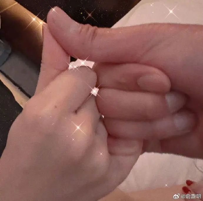 热搜第一!俞灏明、王晓晨官宣结婚,男方15年前曾在拍戏时遇火灾容貌受损(组图) - 4