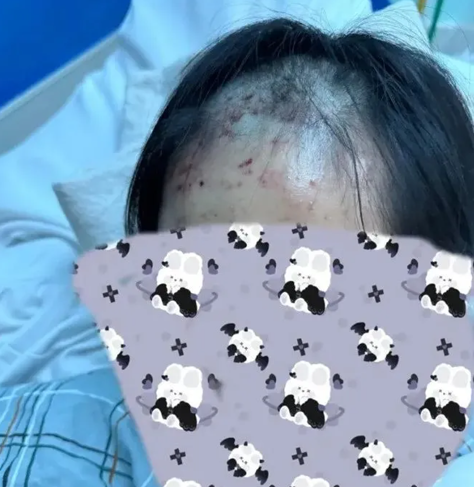 气愤！两华裔少女遭15人暴力围殴致重伤，铁棒殴打、掐颈、强行剃发（组图） - 3