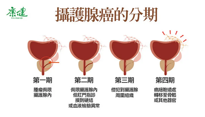 拜登确诊前列腺癌，他曾数次患癌，这次有生命危险吗？（组图） - 3