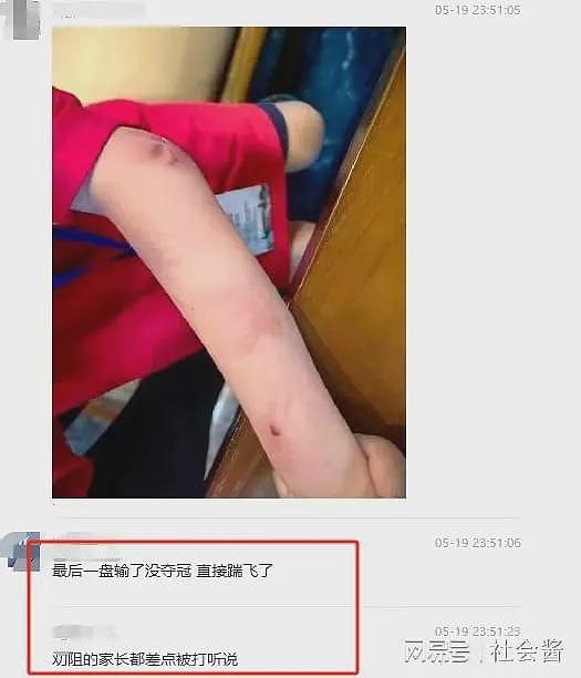 网传天才围棋少年跳楼身亡：长期遭父亲当众殴打，获冠军还不满意（组图） - 7