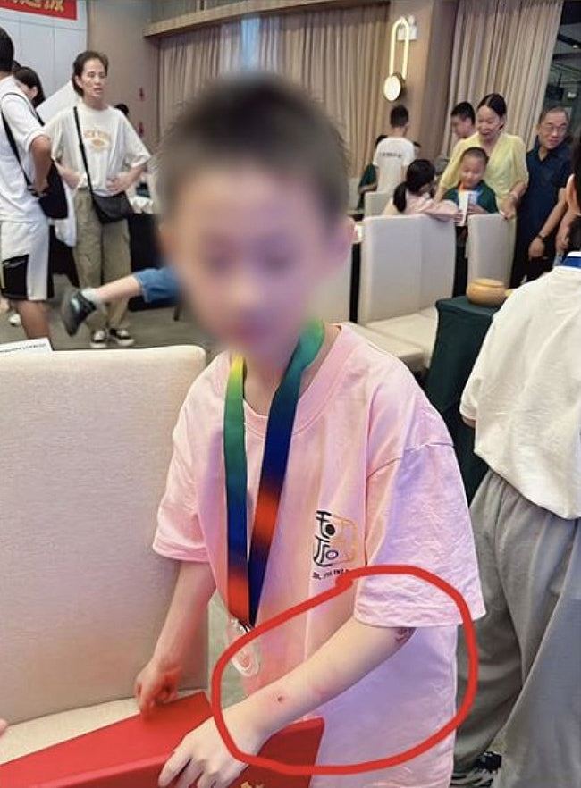 福建9岁围棋神童朱宏鑫传堕楼亡,曾输棋被父亲当众踹打,手臂满伤痕(组图) - 4