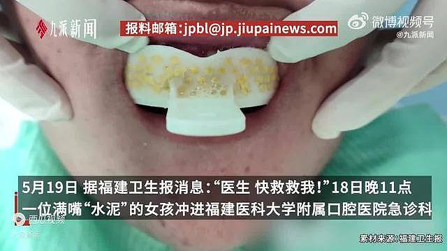 女子DIY自取牙模,拿错材料导致嘴被石膏焊死(图) - 1