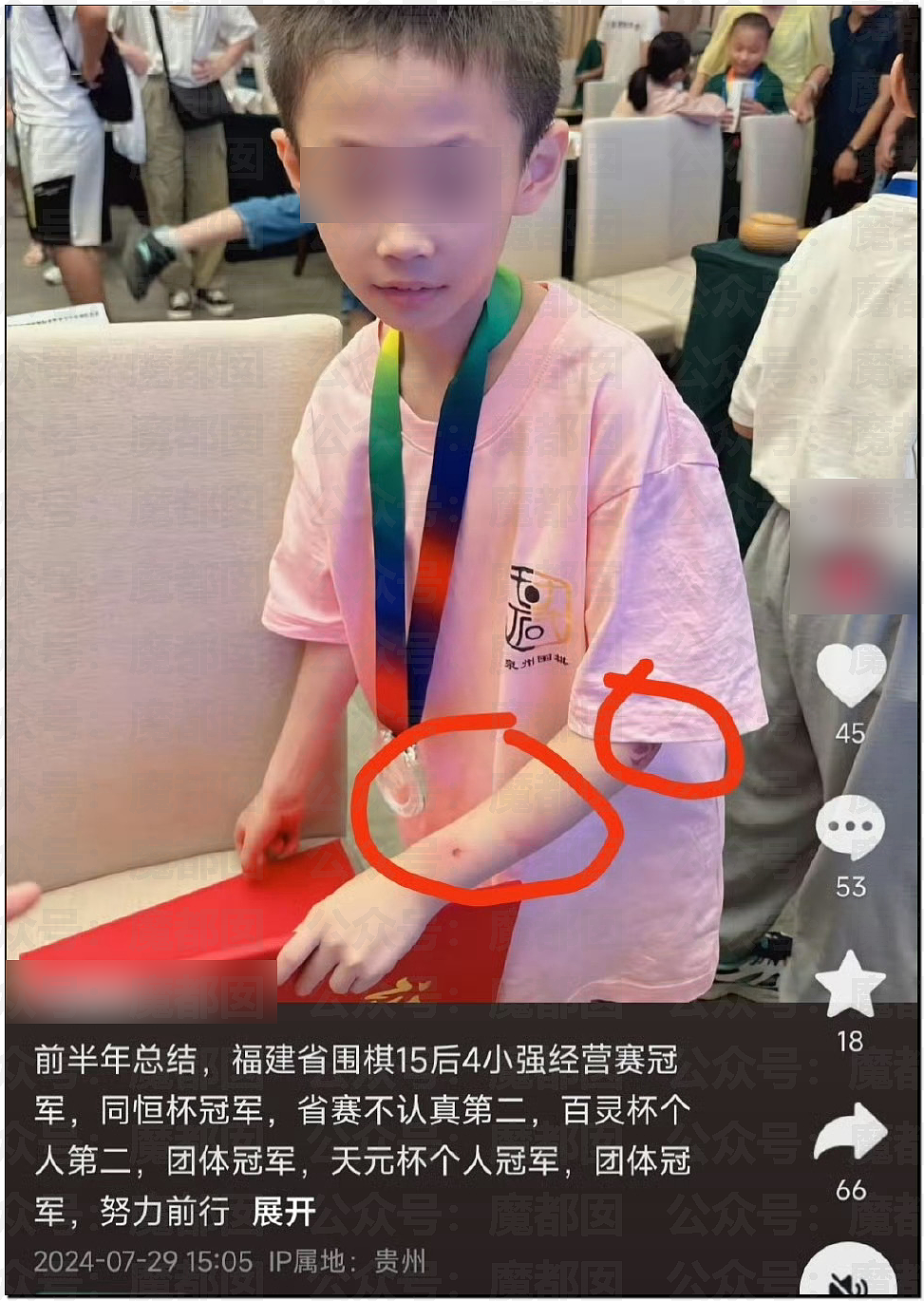 中国9岁围棋神童跳楼身亡，生前频遭父亲家暴殴打！事件曝光引众怒（视频/组图） - 8