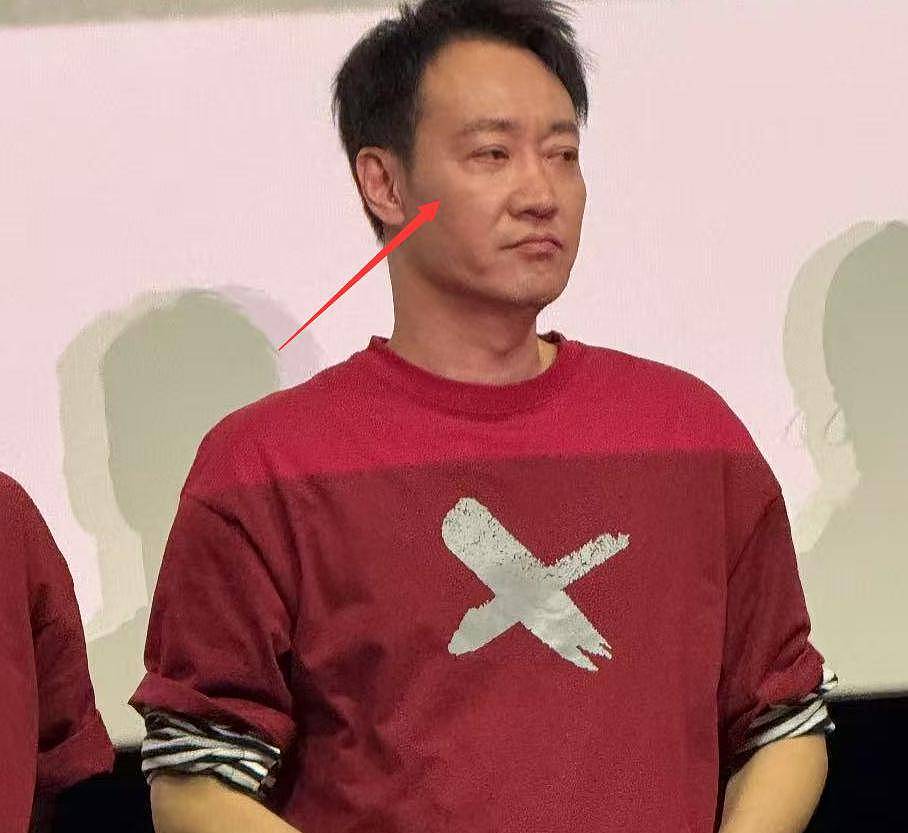 演员朱媛媛去世，医生公开住院照，穿着病号服，临终前只能吃流食（组图） - 20
