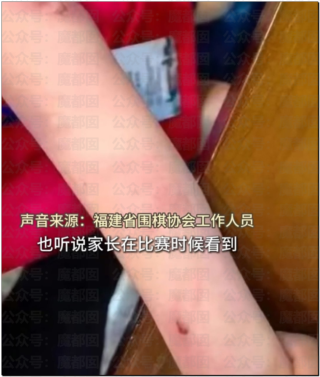 中国9岁围棋神童跳楼身亡，生前频遭父亲家暴殴打！事件曝光引众怒（视频/组图） - 9