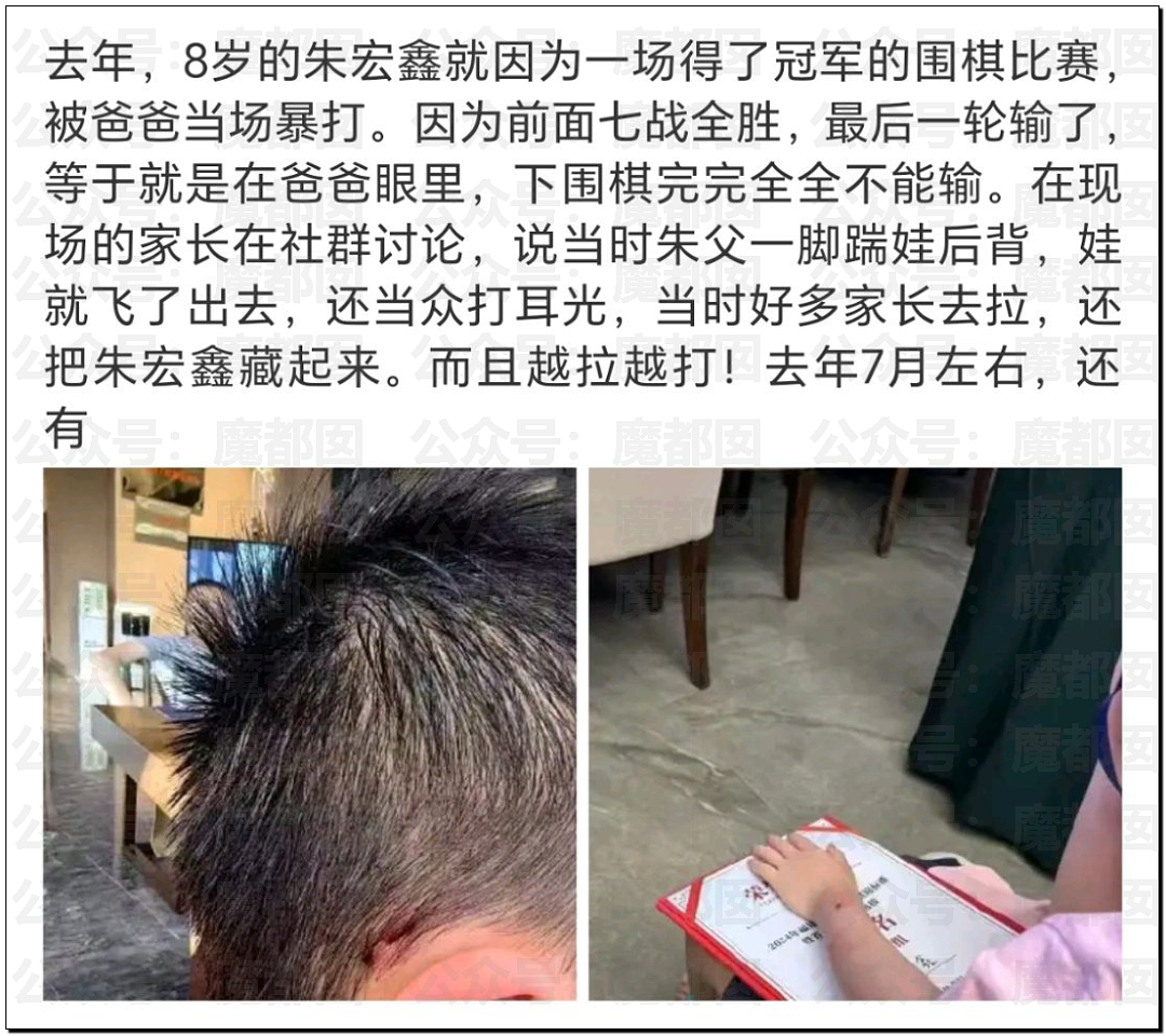 中国9岁围棋神童跳楼身亡，生前频遭父亲家暴殴打！事件曝光引众怒（视频/组图） - 7