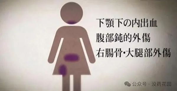 山西男童被虐待致死，继父被判死刑，这些孩子都死在生父母的现任手上…（组图） - 29