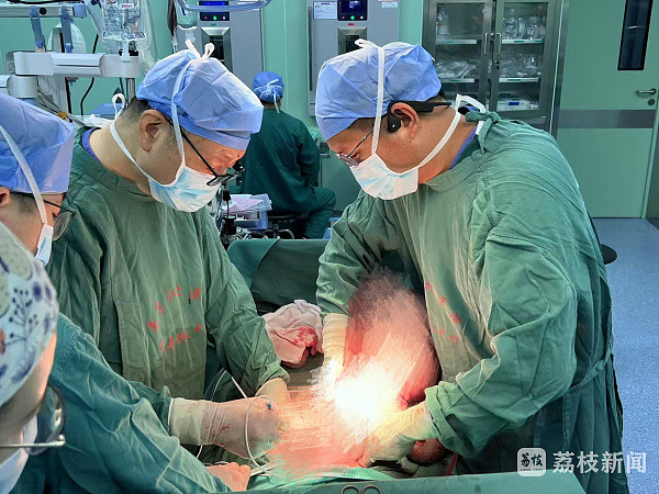 四个月未解大便，男子腹中掏出2米“巨蟒”结肠（图） - 1