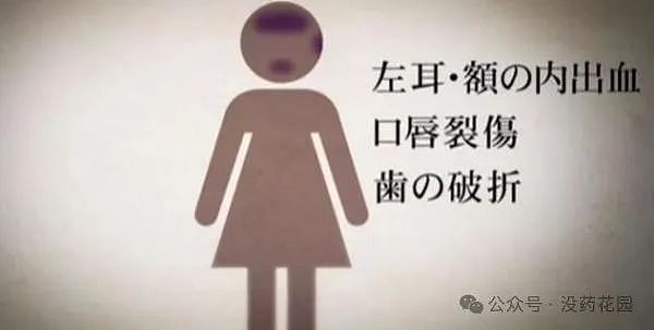 山西男童被虐待致死，继父被判死刑，这些孩子都死在生父母的现任手上…（组图） - 28