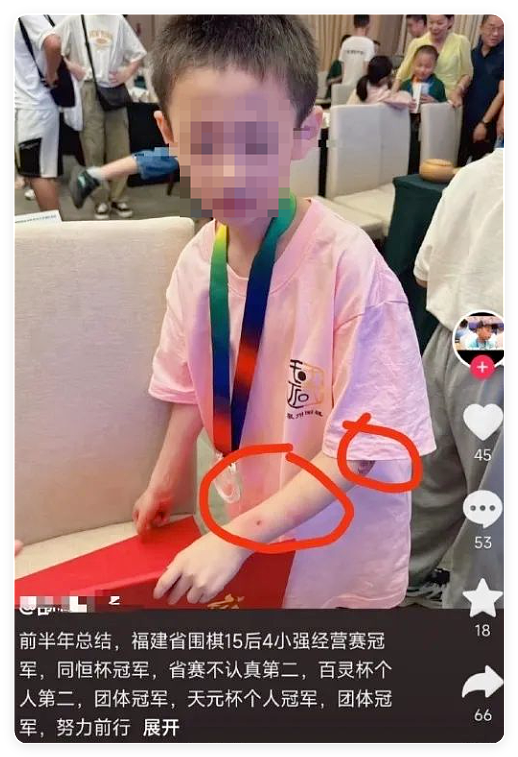 9岁冠军少年跳楼身亡，死因就藏在他爸爸的朋友圈里（组图） - 5