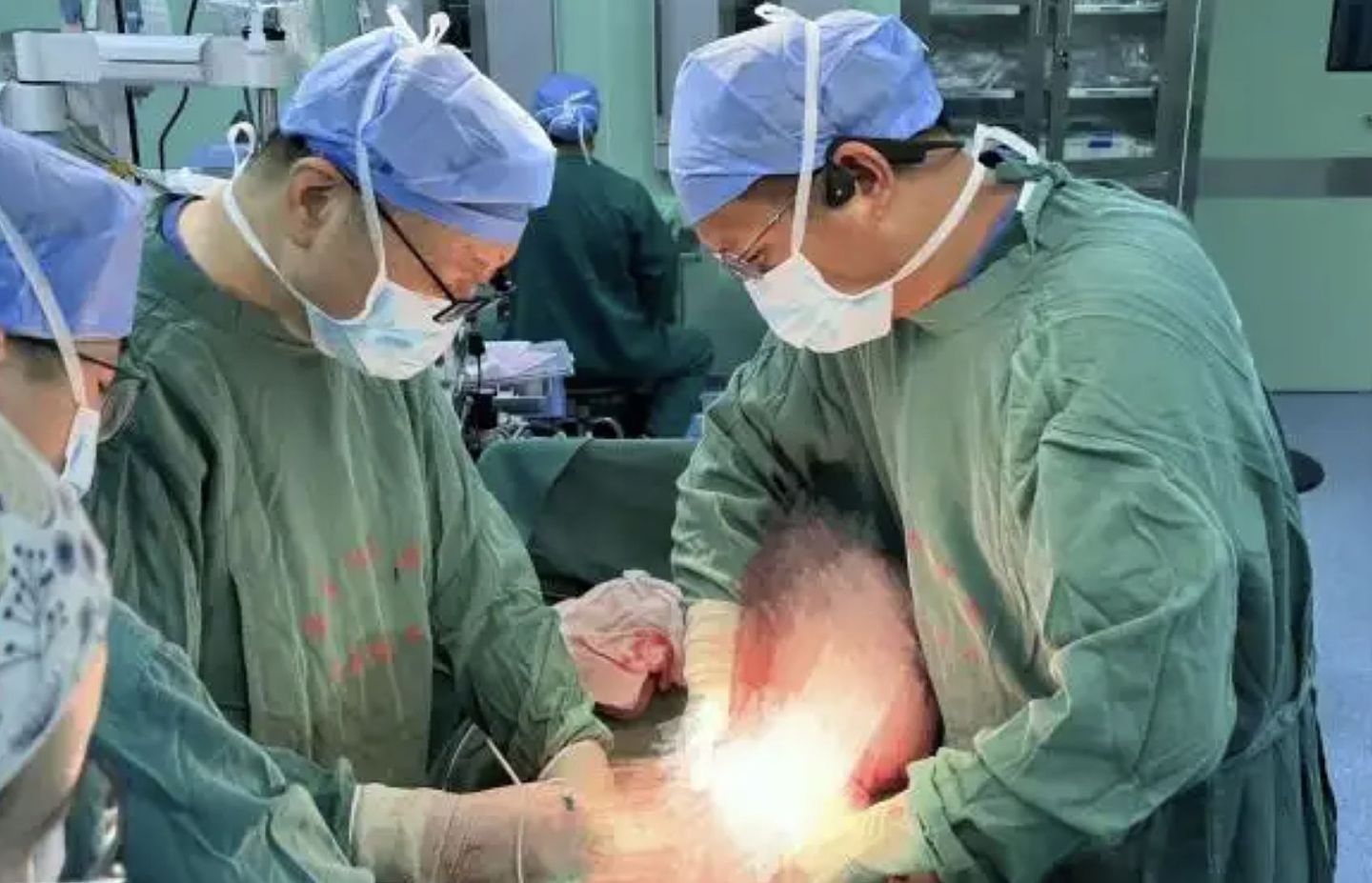 中国男子便秘4个月“腹肿如怀孕”！医生掏出2公尺坏死“屎前巨蟒”（组图） - 3