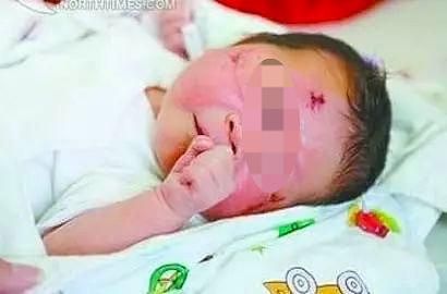 厦门车祸“奇迹宝宝”11岁了：孩子五年来首次见到外婆，奶奶与叔叔因赔偿款反目（组图） - 1