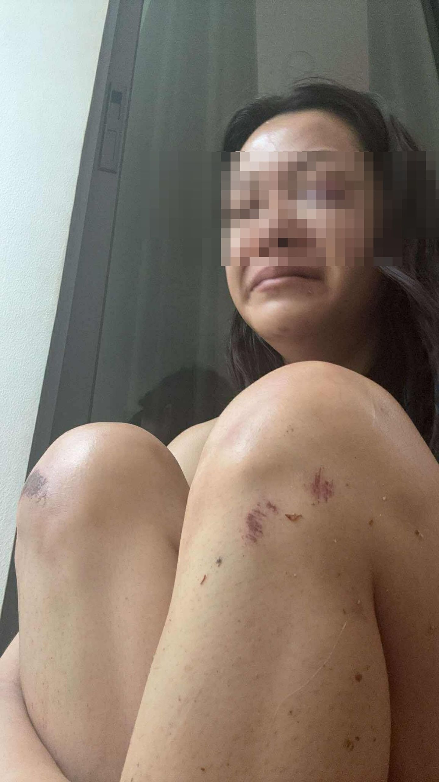女星遭警二代前男友家暴!肿成猪头还喷血,恐怖囚禁画面曝光(组图) - 2