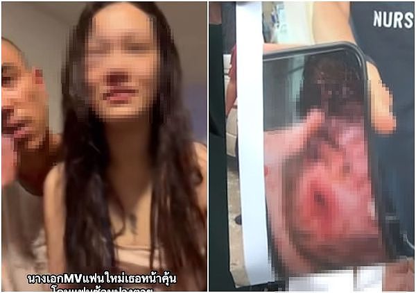女星遭警二代前男友家暴!肿成猪头还喷血,恐怖囚禁画面曝光(组图) - 1