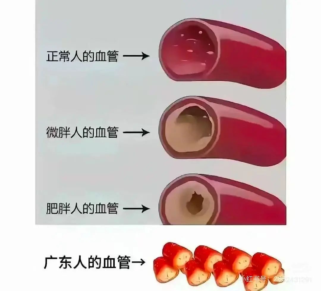 【爆笑】“撞衫经历到底能尴尬到什么地步...？”大爷大妈：穿的像我你无需自卑（组图） - 65