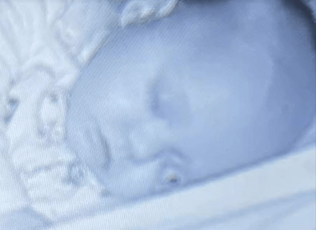 英国妈妈查看监视器吓呆！女儿熟睡竟“掉出眼珠”真相令人哭笑不得（组图） - 3