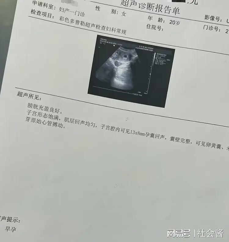 网友自曝和网红开房，一夜五六次后次日怀孕，被索要5000元（组图） - 6