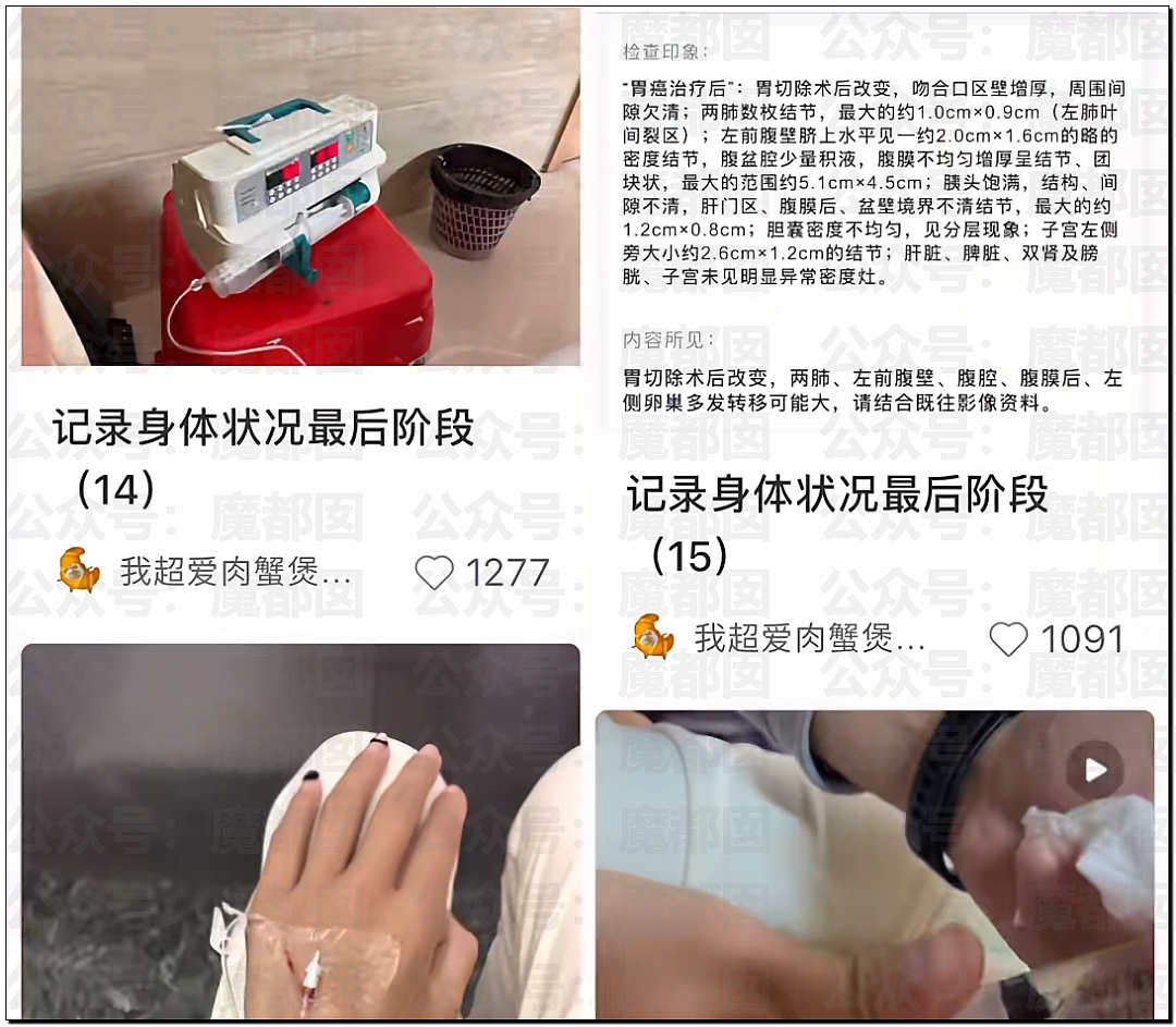 警醒！不吃早饭、不规律、爱吃辣…超美网红女博主胃癌去世（组图） - 10