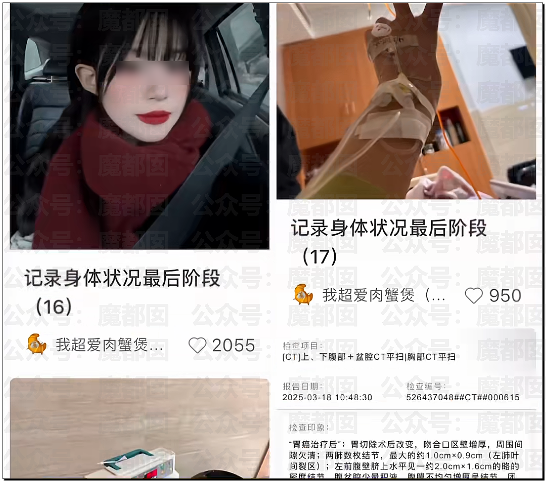 警醒！不吃早饭、不规律、爱吃辣…超美网红女博主胃癌去世（组图） - 9