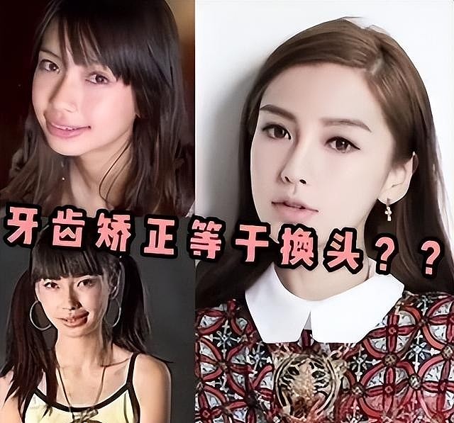 假胸、假屁股、假肌肉,半个娱乐圈从头假到脚,还有什么是真的(组图) - 6