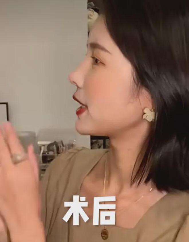宋祖儿复出二连爆,80斤都不到的她是怎么哭出双下巴的?(组图) - 23