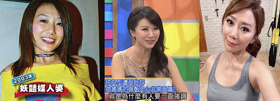 整容了60多次？嫁医生方便终身动脸，削骨换脸都是小场面，她对“人工制造”上瘾了？（组图） - 30