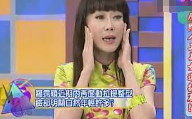 整容了60多次？嫁医生方便终身动脸，削骨换脸都是小场面，她对“人工制造”上瘾了？（组图） - 15